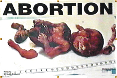 fetus heart pro life fetus heart pro life